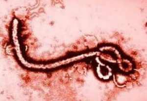 Ebola under the microscope.  From: http://ebolaviros.com/images/0.jpg